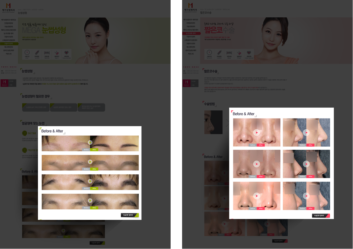 veiw_메가성형외과_10.png 메가성형외과 병원사이트제작