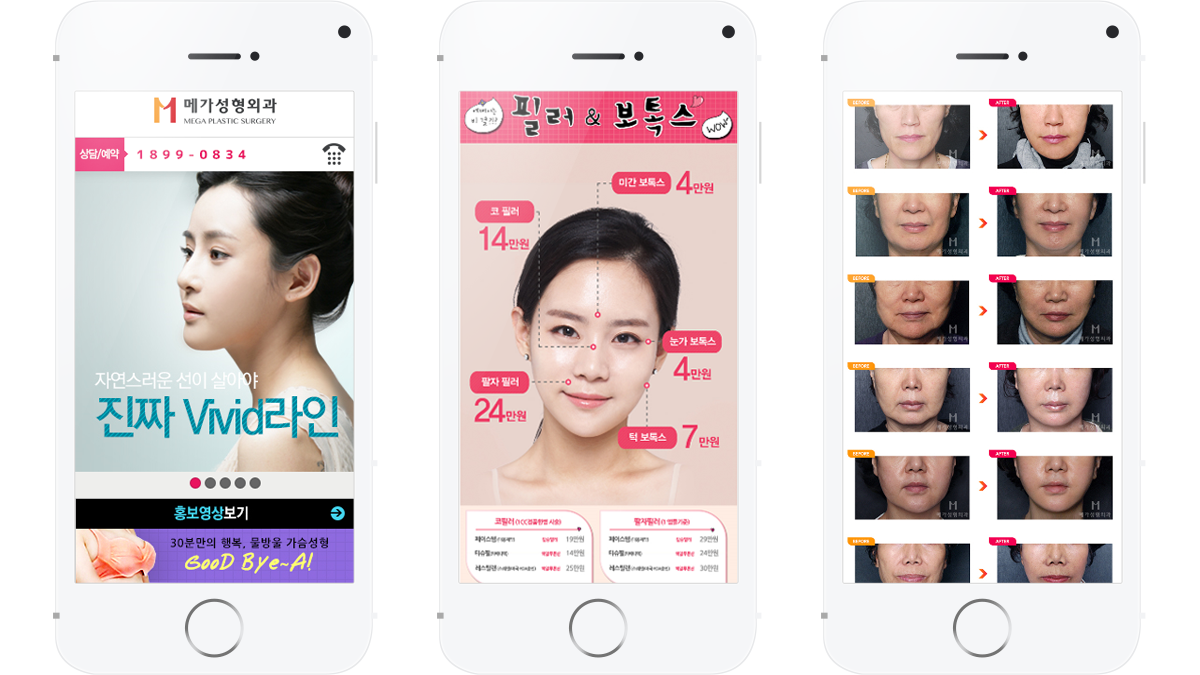 veiw_메가성형외과_12.png 메가성형외과 병원웹사이트