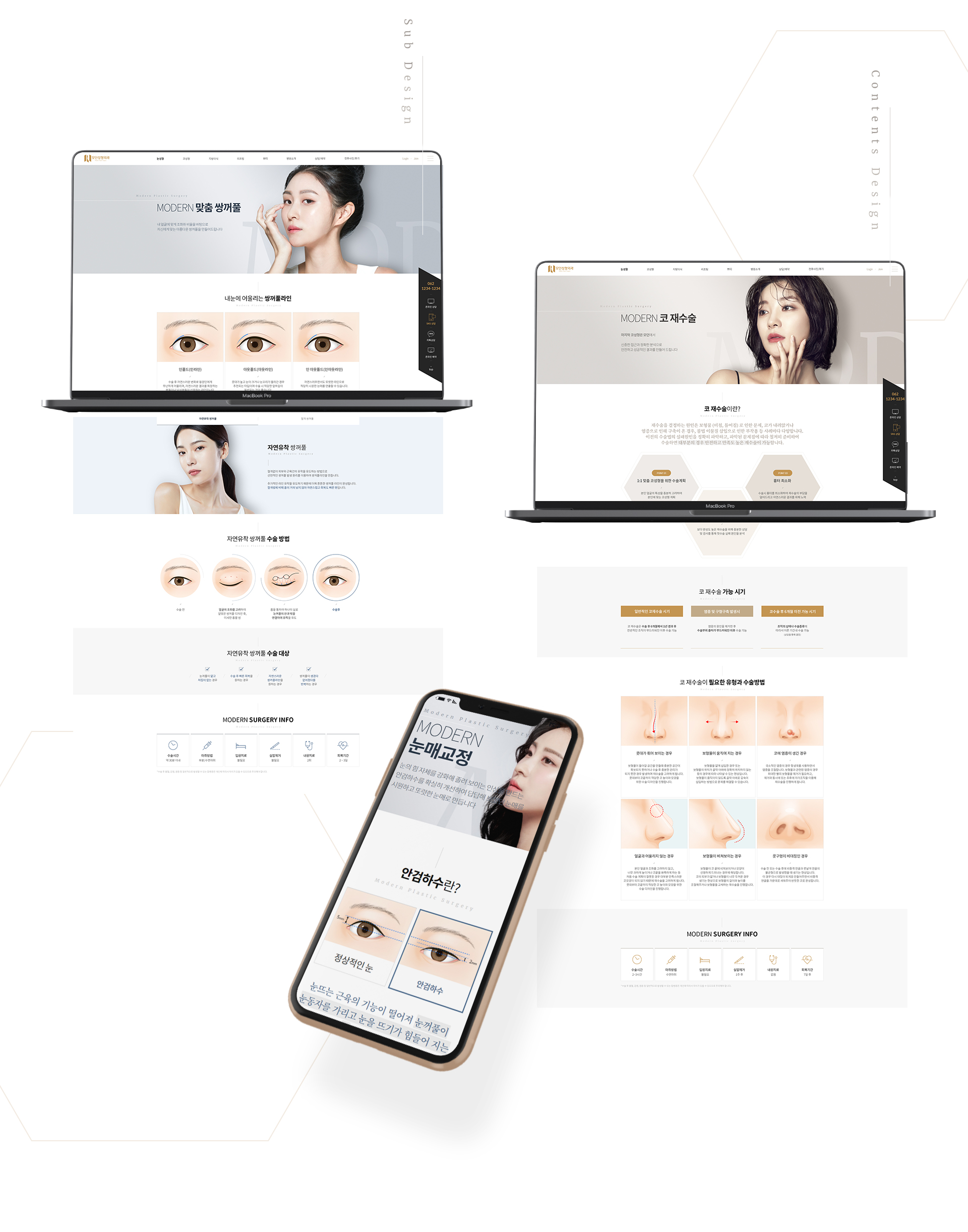 모던성형외과 성형외과홈페이지