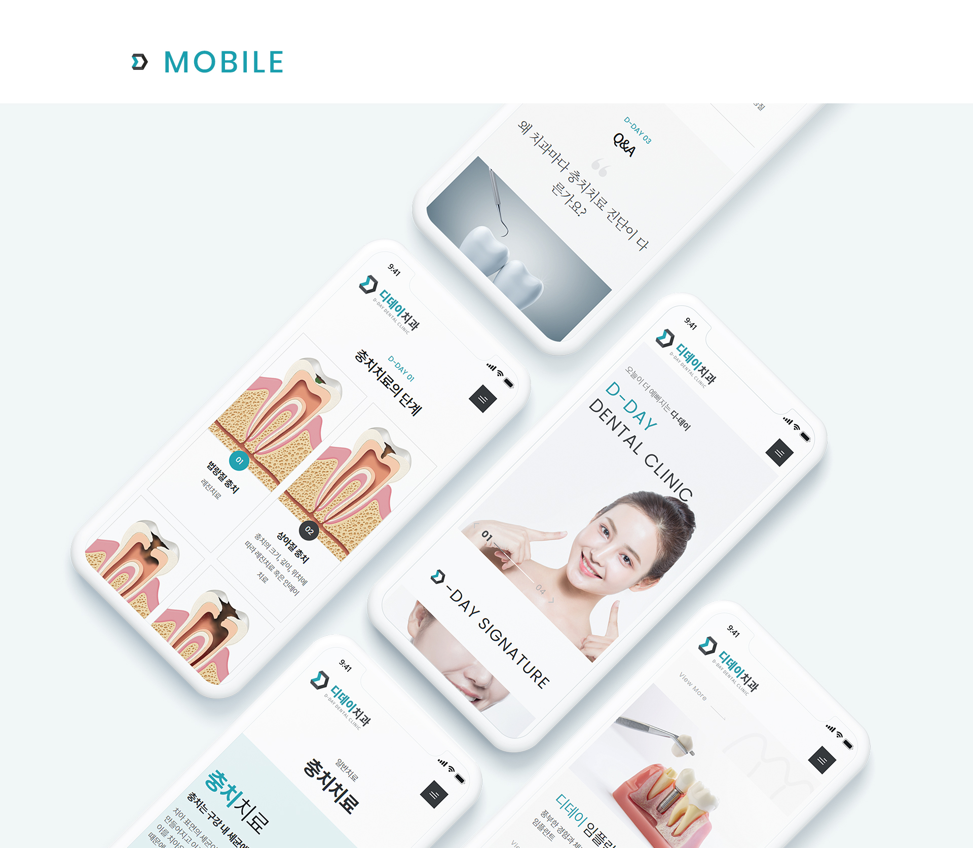 디데이치과 병원홈페이지디자인
