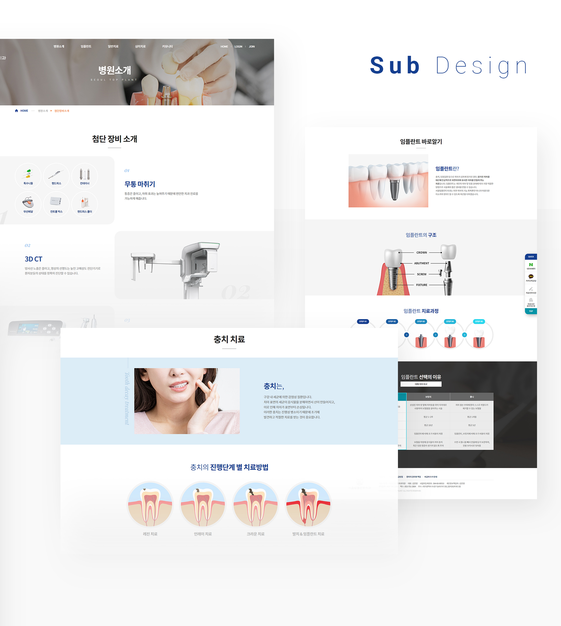 서울탑플란트치과 병원웹사이트