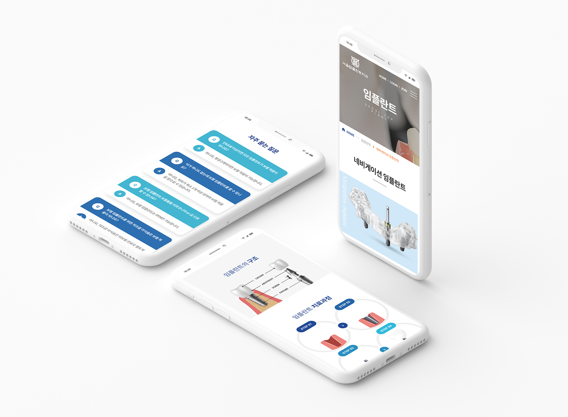 서울탑플란트치과 병원홈페이지디자인