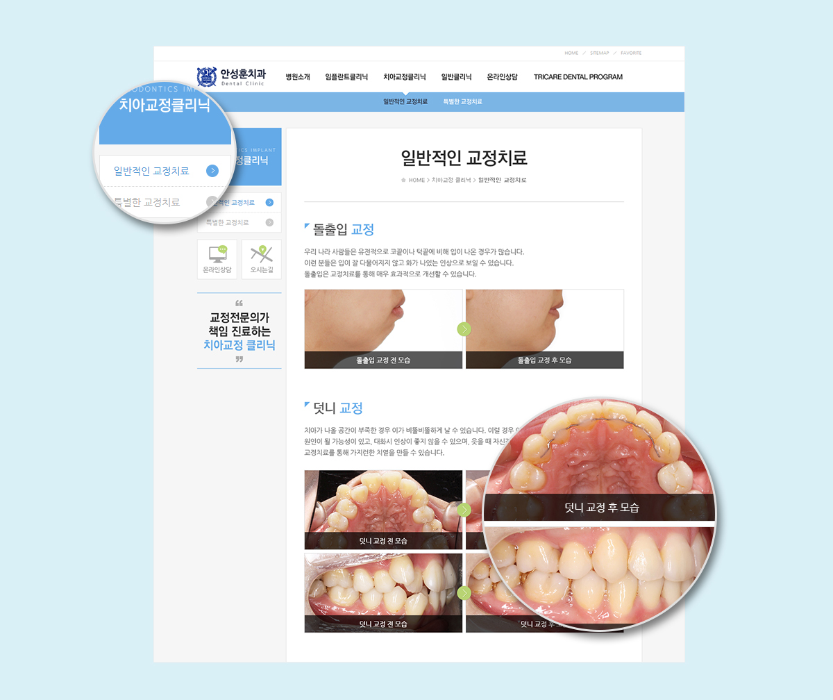 안성훈치과 홈페이지제작