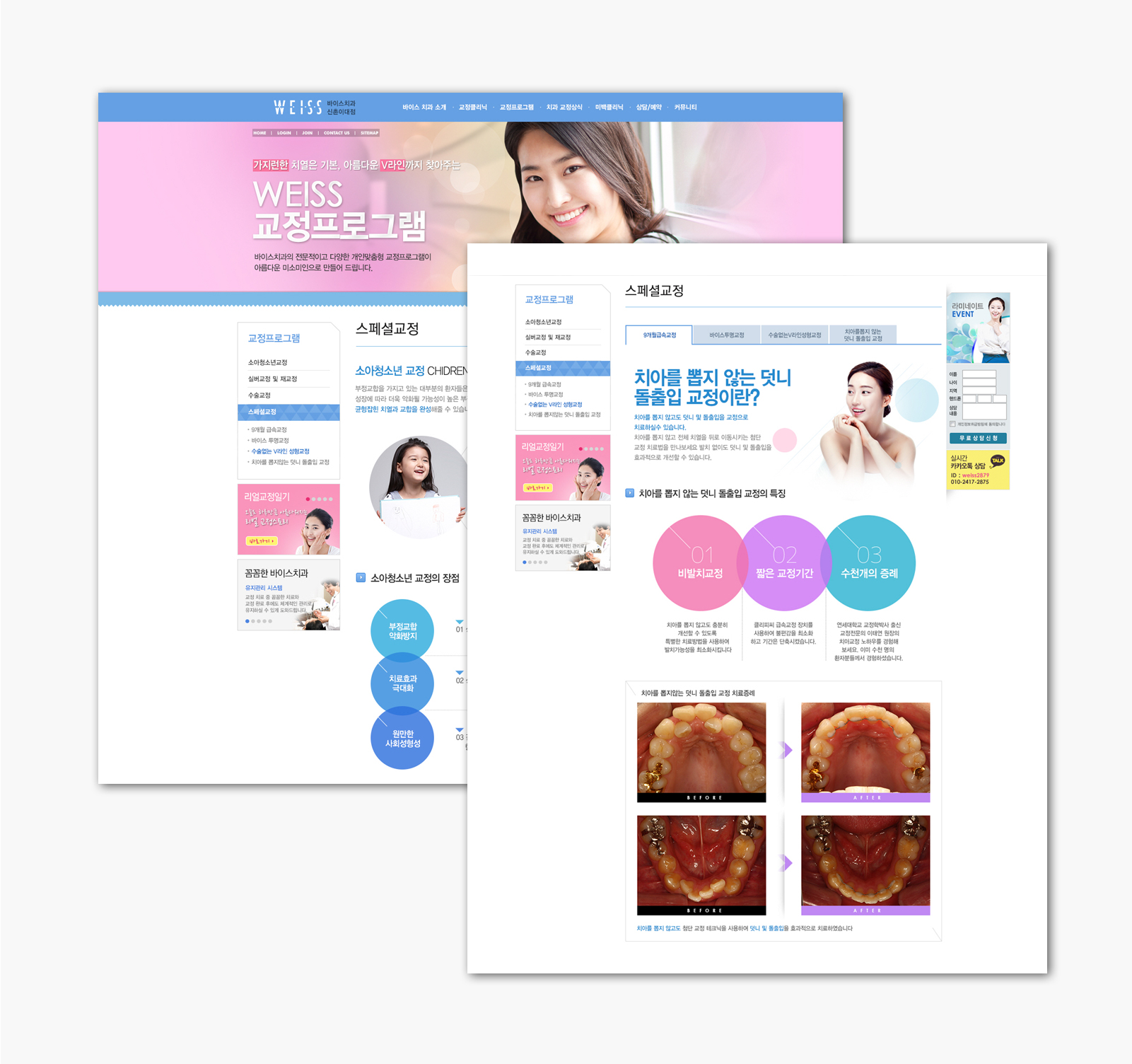 바이스치과 치과홈페이지제작