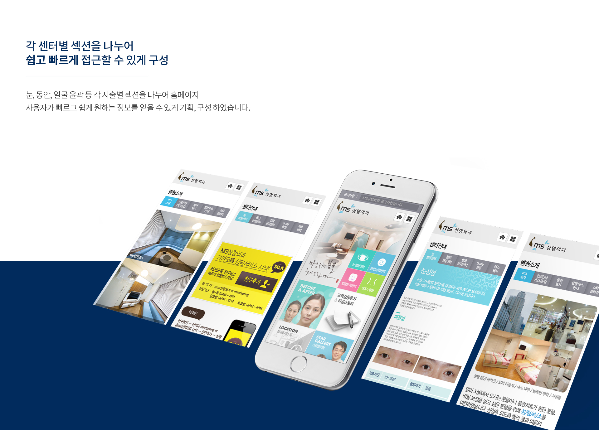 ms성형외과 병원전문홈페이지