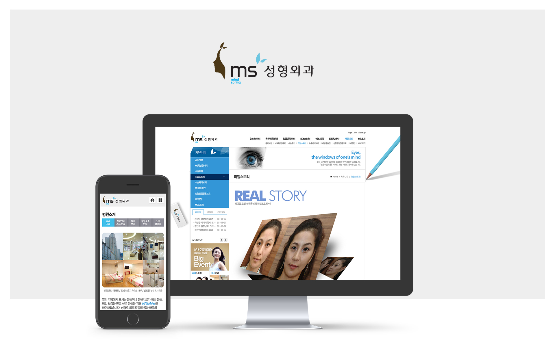 ms성형외과 성형외과홈페이지