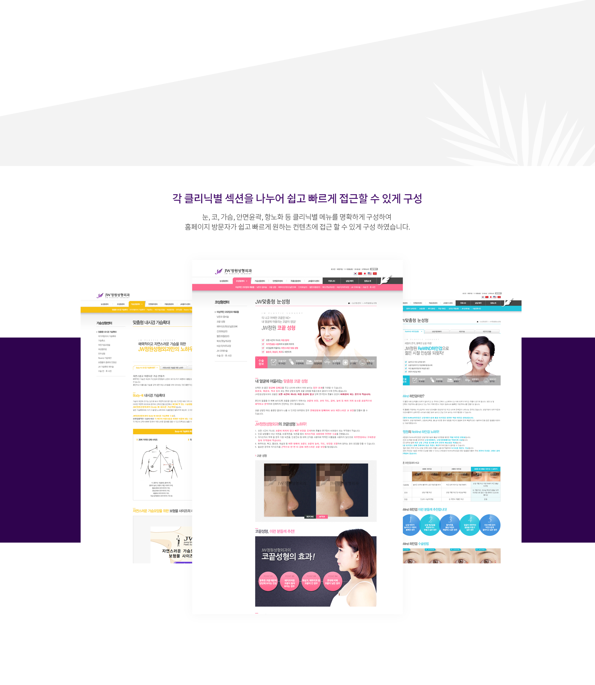 정원성형외과 성형외과홈페이지