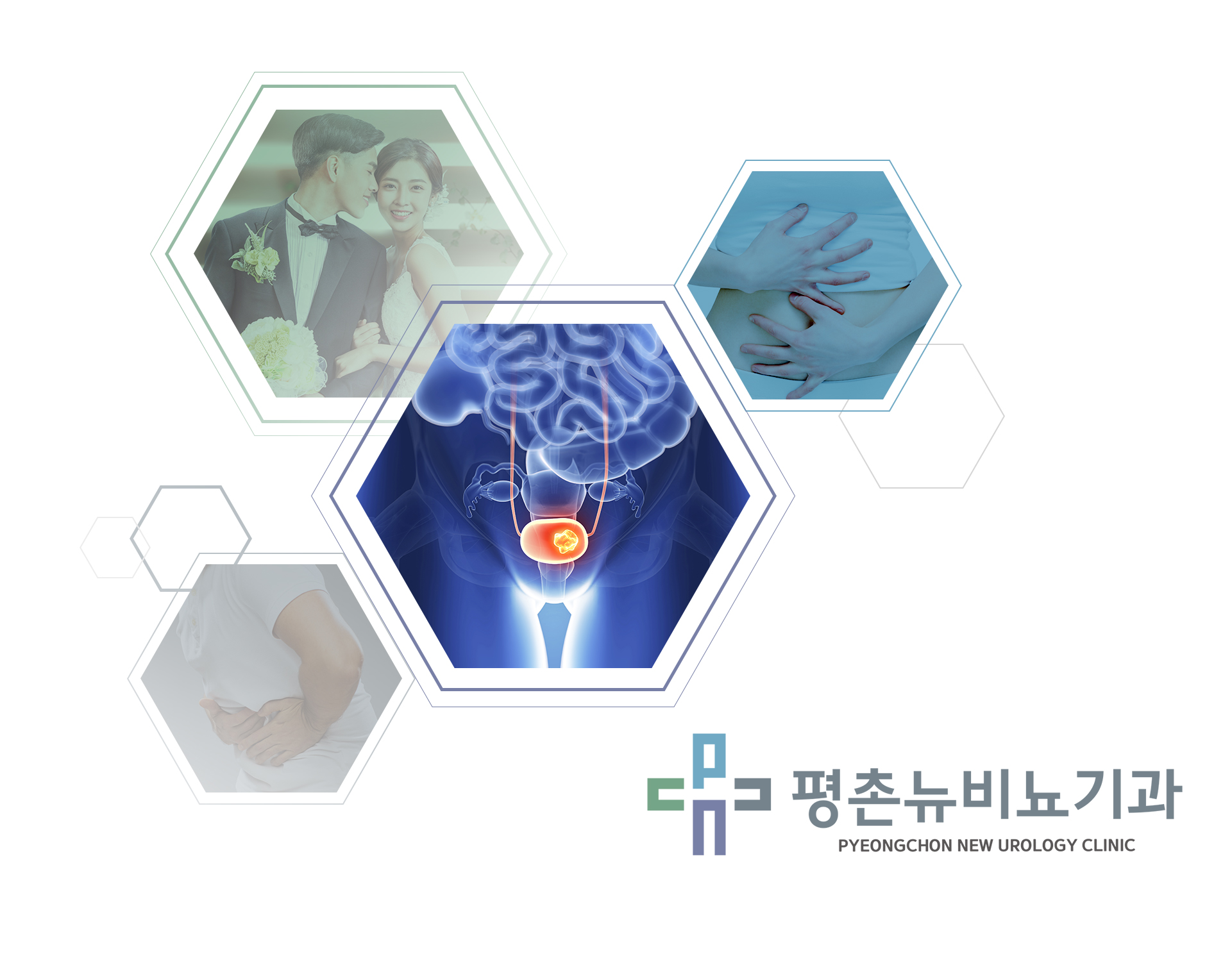 평촌뉴비뇨기과 홈페이지제작